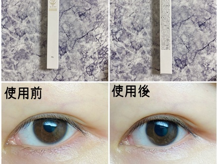 �A�C�A�N�g,���R�~,�A�b�g�R�X��