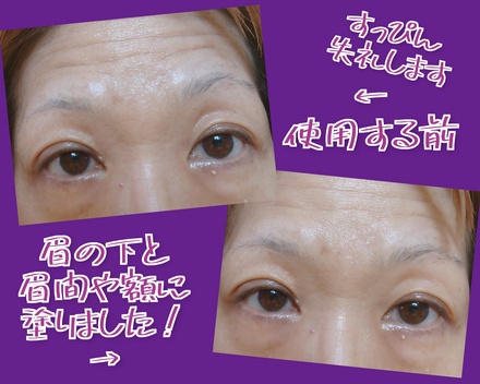 �A�C�A�N�g,���R�~,�A�b�g�R�X��